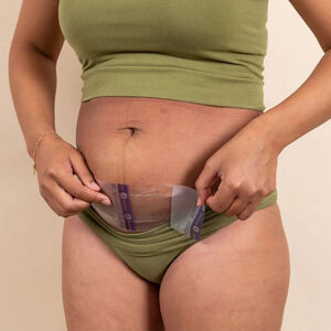 Set van 2 hydrogelpatches voor keizersnede met verkoelend effect 